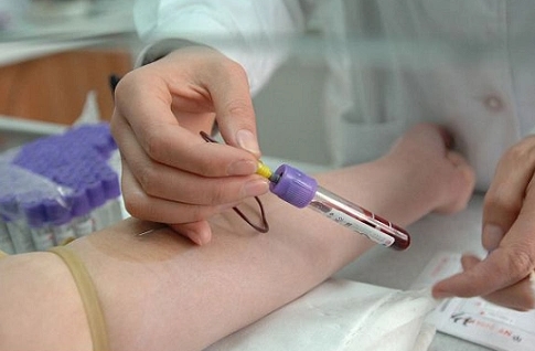 激素六項檢查多少錢？激素六項檢查收費標準