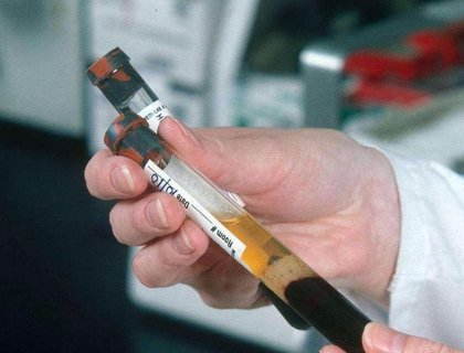 杭州試管嬰兒費用大概要多少錢？杭州試管嬰兒費用全解析