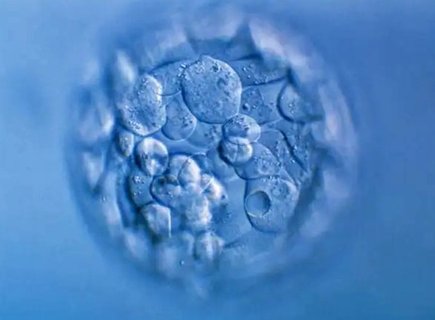 試管嬰兒要準備多少錢？中美泰三國費用對比