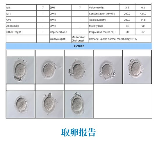 取卵報告 取卵報告