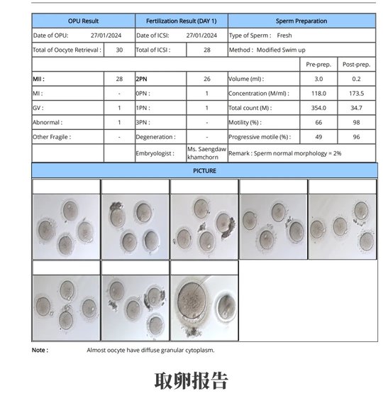 從絕望到希望：多囊卵巢患者6年艱辛求子，終在DHC圓滿！